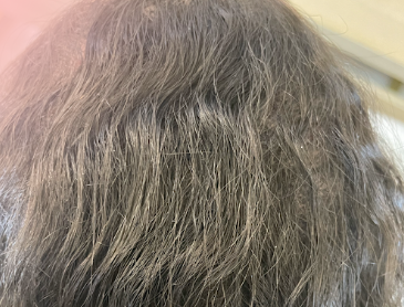After